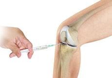 Cortisone Injection