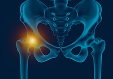 Hip pain