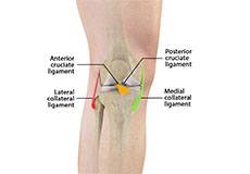 Ligament Injuries