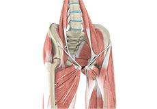 Muscle Strain (Hip)